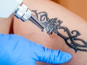 Tatto removing on screen
